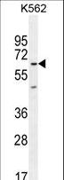 KBTBD5 Antibody - KBTBD5 Antibody western blot of K562 cell line lysates (35 ug/lane). The KBTBD5 antibody detected the KBTBD5 protein (arrow).