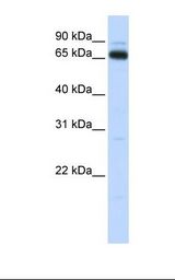 KBTBD5 Antibody - Fetal muscle lysate. Antibody concentration: 1.0 ug/ml. Gel concentration: 12%.  This image was taken for the unconjugated form of this product. Other forms have not been tested.
