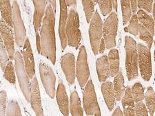 KBTBD5 Antibody - Immunochemical staining of human KLHL40 in human skeletal muscle with rabbit polyclonal antibody at 1:100 dilution, formalin-fixed paraffin embedded sections.