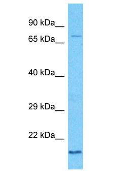 KBTBD6 Antibody - KBTBD6 antibody Western Blot of HT1080. Antibody dilution: 1 ug/ml.  This image was taken for the unconjugated form of this product. Other forms have not been tested.