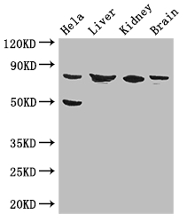 KBTBD6 Antibody - Positive WB detected in:Hela whole cell lysate,Mouse liver tissue,Mouse kidney tissue,Mouse brain tissue;All lanes: KBTBD6 antibody at 3.4ug/ml;Secondary;Goat polyclonal to rabbit IgG at 1/50000 dilution;Predicted band size: 77 kDa;Observed band size: 77,50 kDa;