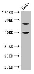 KBTBD6 Antibody - Western Blot Positive WB detected in: Hela whole cell lysate All lanes: KBTBD6 antibody at 3.4µg/ml Secondary Goat polyclonal to rabbit IgG at 1/50000 dilution Predicted band size: 77 kDa Observed band size: 77 kDa