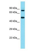 KBTBD6 Antibody - KBTBD6 antibody Western Blot of HeLa. Antibody dilution: 1 ug/ml.  This image was taken for the unconjugated form of this product. Other forms have not been tested.