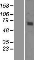 KBTBD6 Protein - Western validation with an anti-DDK antibody * L: Control HEK293 lysate R: Over-expression lysate