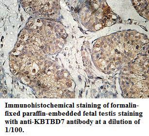 KBTBD7 Antibody