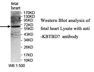 KBTBD7 Antibody