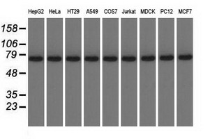 KBTBD7 Antibody - Western blot of extracts (35 ug) from 9 different cell lines by using anti-KBTBD7 monoclonal antibody.