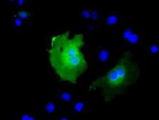 KBTBD7 Antibody - Anti-KBTBD7 mouse monoclonal antibody  immunofluorescent staining of COS7 cells transiently transfected by pCMV6-ENTRY KBTBD7.