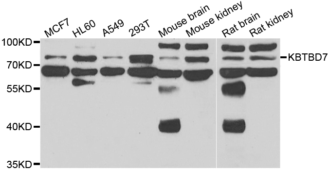 KBTBD7 Antibody - Western blot analysis of extracts of various cell lines.