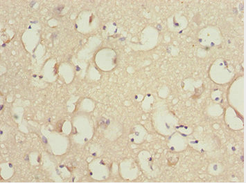 KBTBD7 Antibody - Immunohistochemistry of paraffin-embedded human brain tissue at dilution 1:100