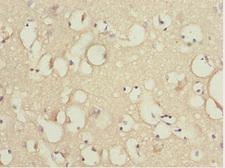 KBTBD7 Antibody - Immunohistochemistry of paraffin-embedded human brain tissue at dilution 1:100