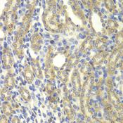 KBTBD7 Antibody - Immunohistochemistry of paraffin-embedded Rat kidney using KBTBD7 Polyclonal Antibody at dilution of 1:100 (40x lens).