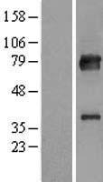 KBTBD7 Protein - Western validation with an anti-DDK antibody * L: Control HEK293 lysate R: Over-expression lysate