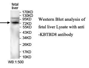 KBTBD8 Antibody