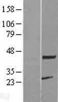 KCMF1 Protein - Western validation with an anti-DDK antibody * L: Control HEK293 lysate R: Over-expression lysate