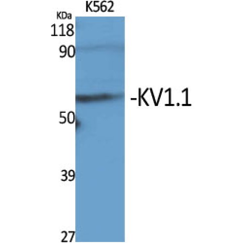 KCNA1 / Kv1.1 Antibody - Western blot of KV1.1 antibody