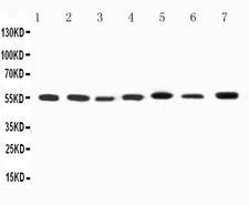 KCNA1 / Kv1.1 Antibody - WB of KCNA1 / Kv1.1 antibody. All lanes: Anti-KCNA1 at 0.5ug/ml. Lane 1: Rat Brain Tissue Lysate at 40ug. Lane 2: Rat Testis Tissue Lysate at 40ug. Lane 3: Rat Cardiac Muscle Tissue Lysate at 40ug. Lane 4: HELA Whole Cell Lysate at 40ug. Lane 5: U87 Whole Cell Lysate at 40ug. Lane 6: SHG Whole Cell Lysate at 40ug. Lane 7: NEURO Whole Cell Lysate at 40ug. Predicted bind size: 56KD. Observed bind size: 56KD.