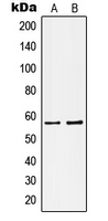 KCNA1 / Kv1.1 Antibody - Western blot analysis of Kv1.1 expression in HEK293 (A); MCF7 (B) whole cell lysates.
