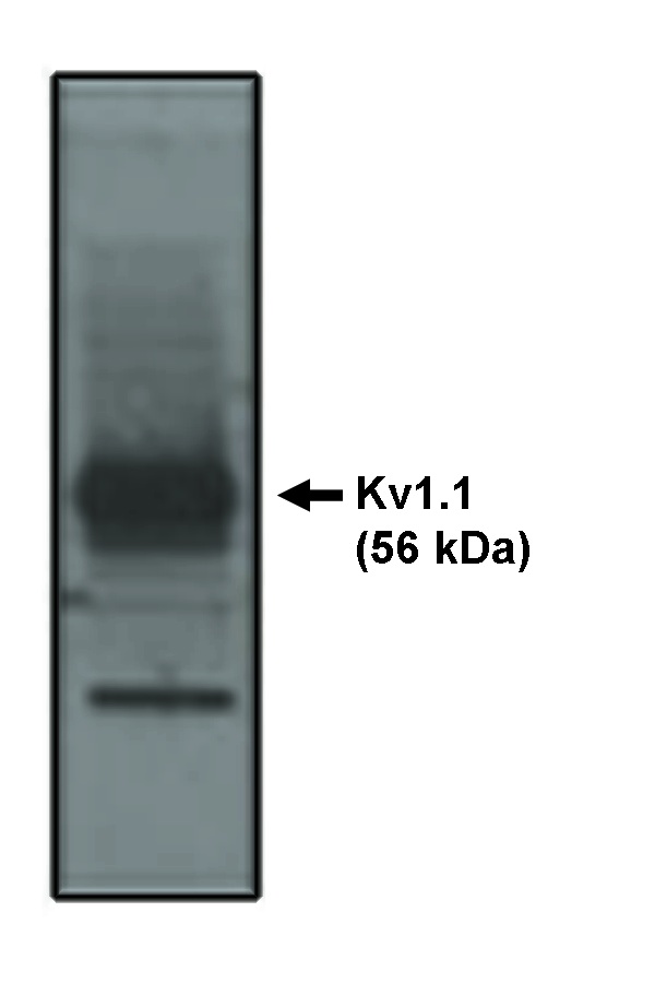 KCNA1 / Kv1.1 Antibody - Western blot of Kv1.1 antibody on rat brain lysate.