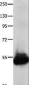 KCNA1 / Kv1.1 Antibody - Western blot analysis of Human kidney cancer tissue, using KCNA1 Polyclonal Antibody at dilution of 1:600.