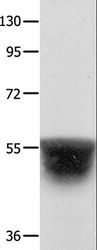 KCNA1 / Kv1.1 Antibody - Western blot analysis of Human brain malignant glioma tissue, using KCNA1 Polyclonal Antibody at dilution of 1:400.