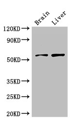 KCNA1 / Kv1.1 Antibody - Positive WB detected in:Mouse brain tissue,Rat liver tissue;All lanes:KCNA1 antibody at 3?g/ml;Secondary;Goat polyclonal to rabbit IgG at 1/50000 dilution;Predicted band size: 57 KDa;Observed band size: 57 KDa;