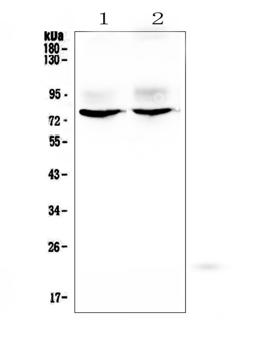 KCNA1 / Kv1.1 Antibody - Western blot analysis of KCNA1 using anti-KCNA1 antibody. Electrophoresis was performed on a 5-20% SDS-PAGE gel at 70V (Stacking gel) / 90V (Resolving gel) for 2-3 hours. The sample well of each lane was loaded with 50ug of sample under reducing conditions. Lane 1: rat brain tissue lysates,Lane 2: mouse brain tissue lysates. After Electrophoresis, proteins were transferred to a Nitrocellulose membrane at 150mA for 50-90 minutes. Blocked the membrane with 5% Non-fat Milk/ TBS for 1.5 hour at RT. The membrane was incubated with rabbit anti-KCNA1 antigen affinity purified polyclonal antibody at 0.5 µg/mL overnight at 4°C, then washed with TBS-0.1% Tween 3 times with 5 minutes each and probed with a goat anti-rabbit IgG-HRP secondary antibody at a dilution of 1:10000 for 1.5 hour at RT. The signal is developed using an Enhanced Chemiluminescent detection (ECL) kit with Tanon 5200 system. A specific band was detected for KCNA1 at approximately 75KD. The expected band size for KCNA1 is at 56KD.