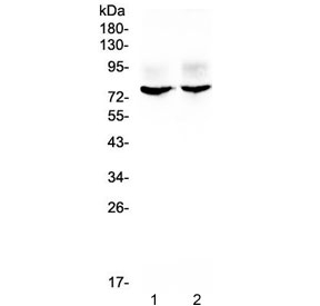 KCNA1 / Kv1.1 Antibody - Western blot testing of 1) rat brain and 2) mouse brain lysate with KCNA1 antibody at 0.5ug/ml. Expected molecular weight: 56-85 kDa depending on glycosylation level.