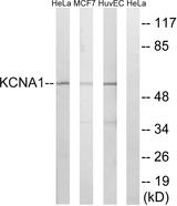 KCNA1 / Kv1.1 Antibody - Western blot analysis of extracts from HeLa cells, MCF-7 cells and HuvEc cells, using KCNA1 antibody.