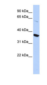 KCNA10 Antibody - KCNA10 / Kv1.8 antibody Western blot of HepG2 cell lysate. This image was taken for the unconjugated form of this product. Other forms have not been tested.