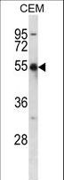 KCNA2 / Kv1.2 Antibody - KCNA2 Antibody western blot of CEM cell line lysates (35 ug/lane). The KCNA2 antibody detected the KCNA2 protein (arrow).