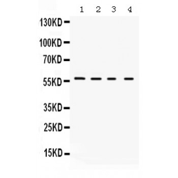 KCNA2 / Kv1.2 Antibody - Kv1.2 antibody Western blot. All lanes: Anti Kv1.2 at 0.5 ug/ml. Lane 1: Rat Kidney Tissue Lysate at 50 ug. Lane 2: Rat Brain Tissue Lysate at 50 ug. Lane 3: Mouse Brain Tissue Lysate at 50 ug. Lane 4: Mouse Kidney Tissue Lysate at 50 ug. Predicted band size: 57 kD. Observed band size: 57 kD.