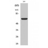 KCNA3 / Kv1.3 Antibody - Western blot of Kv1.3 antibody