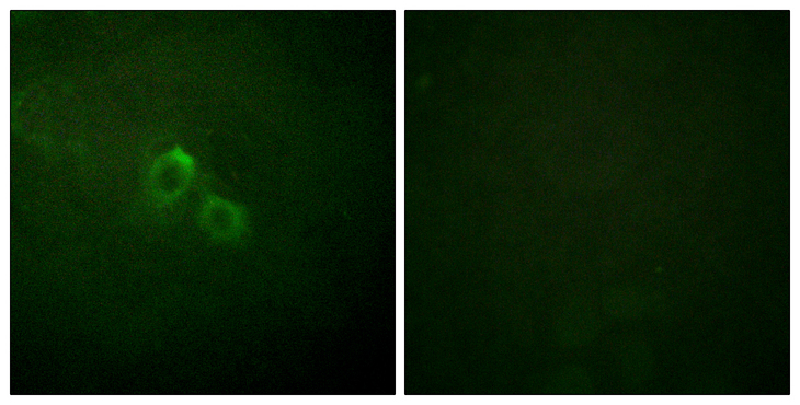 KCNA3 / Kv1.3 Antibody - Immunofluorescence analysis of HUVEC cells, using Kv1.3/KCNA3 Antibody. The picture on the right is blocked with the synthesized peptide.