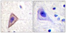 KCNA3 / Kv1.3 Antibody - Immunohistochemistry analysis of paraffin-embedded human brain tissue, using Kv1.3/KCNA3 Antibody. The picture on the right is blocked with the synthesized peptide.