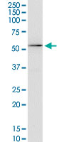 KCNA3 / Kv1.3 Antibody - KCNA3 monoclonal antibody (M01), clone 1D8. Western Blot analysis of KCNA3 expression in Jurkat.
