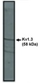 KCNA3 / Kv1.3 Antibody - Western blot of Kv1.3 antibody on rat brain lysate.