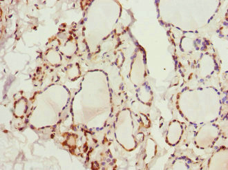 KCNA3 / Kv1.3 Antibody - Immunohistochemistry of paraffin-embedded human thyroid tissue at dilution 1:100