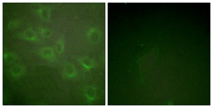 KCNA3 / Kv1.3 Antibody - Immunofluorescence analysis of HUVEC cells, using Kv1.3/KCNA3 (Phospho-Tyr135) Antibody. The picture on the right is blocked with the phospho peptide.