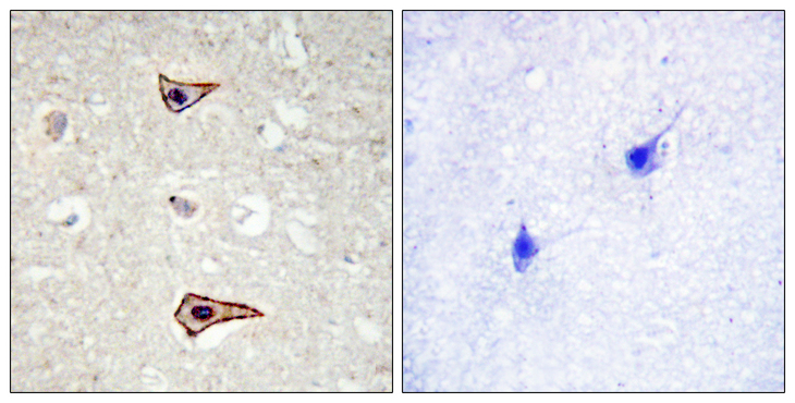 KCNA3 / Kv1.3 Antibody - Immunohistochemistry analysis of paraffin-embedded human brain, using Kv1.3/KCNA3 (Phospho-Tyr135) Antibody. The picture on the right is blocked with the phospho peptide.