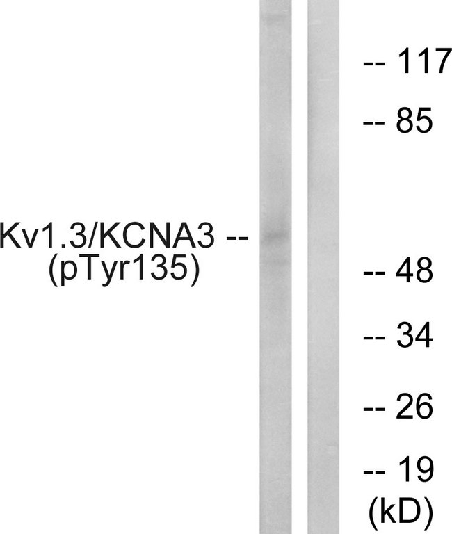 KCNA3 / Kv1.3 Antibody - Western blot analysis of lysates from Jurkat cells treated with starved 24h, using Kv1.3/KCNA3 (Phospho-Tyr135) Antibody. The lane on the right is blocked with the phospho peptide.