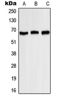 KCNA3 / Kv1.3 Antibody - Western blot analysis of Kv1.3 (pY187) expression in HEK293T EGF-treated (A); SP2/0 EGF-treated (B); PC12 EGF-treated (C) whole cell lysates.