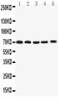 KCNA4 / Kv1.4 Antibody - WB of KCNA4 / KV1.4 antibody. All lanes: Anti-KCNA4 at 0.5ug/ml. Lane 1: Rat Brain Tissue Lysate at 40ug. Lane 2: HY1080Whole Cell Lysate at 40ug. Lane 3: PANC Whole Cell Lysate at 40ug. Lane 4: U87 Whole Cell Lysate at 40ug. Lane 5: SHG Whole Cell Lysate at 40ug. Predicted bind size: 70KD. Observed bind size: 70KD.