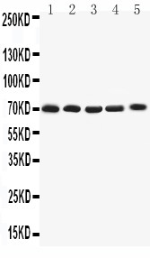 KCNA4 / Kv1.4 Antibody - WB of KCNA4 / KV1.4 antibody. All lanes: Anti-KCNA4 at 0.5ug/ml. Lane 1: Rat Brain Tissue Lysate at 40ug. Lane 2: HY1080Whole Cell Lysate at 40ug. Lane 3: PANC Whole Cell Lysate at 40ug. Lane 4: U87 Whole Cell Lysate at 40ug. Lane 5: SHG Whole Cell Lysate at 40ug. Predicted bind size: 70KD. Observed bind size: 70KD.