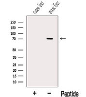 KCNA4 / Kv1.4 Antibody - Western blot analysis of extracts of mouse liver tissue using Kv1.4-Specific antibody. The lane on the left was treated with blocking peptide.