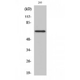 KCNA5 / Kv1.5 Antibody - Western blot of KV1.5 antibody