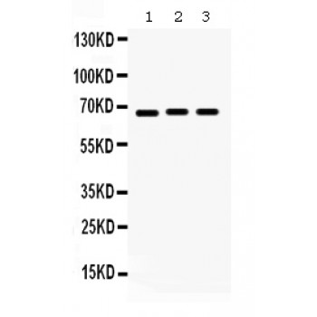 KCNA5 / Kv1.5 Antibody - KCNA5 antibody Western blot. All lanes: Anti KCNA5 at 0.5 ug/ml. Lane 1: 293T Whole Cell Lysate at 40 ug. Lane 2: A549 Whole Cell Lysate at 40 ug. Lane 3: PANC Whole Cell Lysate at 40 ug. Predicted band size: 67 kD. Observed band size: 67 kD.