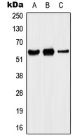 KCNA5 / Kv1.5 Antibody - Western blot analysis of Kv1.5 expression in MCF7 (A); Raw264.7 (B); H9C2 (C) whole cell lysates.