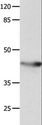 KCNA5 / Kv1.5 Antibody - Western blot analysis of Mouse spleen tissue, using KCNA5 Polyclonal Antibody at dilution of 1:700.