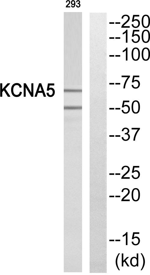 KCNA5 / Kv1.5 Antibody - Western blot analysis of extracts from 293 cells, using KCNA5 antibody.